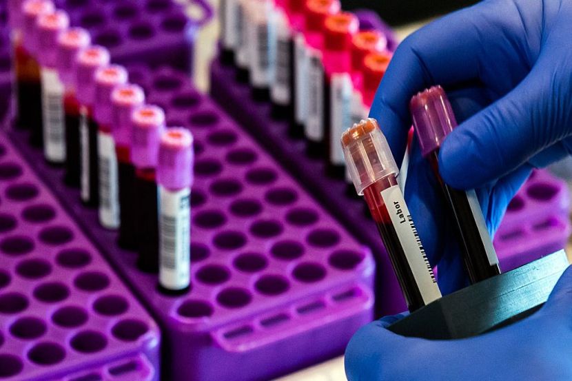 रुपीनगरमध्ये आणखी ३ जणांचे रिपोर्ट 'पॉझिटिव्ह'; आजपर्यंत परिसरात १६ बाधित रूग्ण आढळले