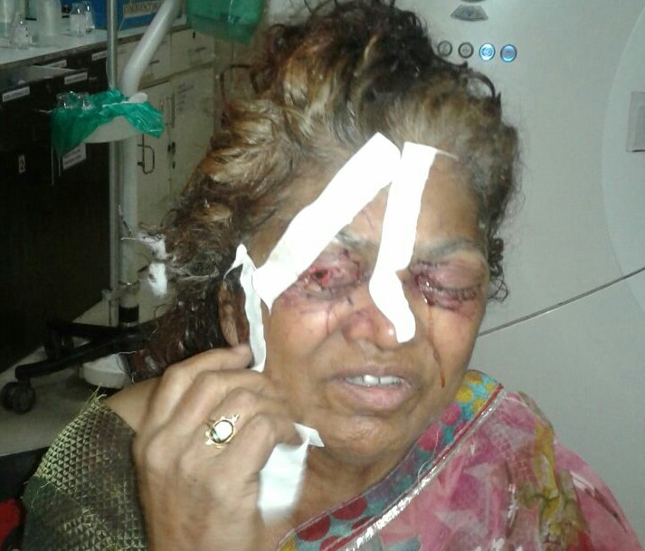 मनोरूग्णाने केला वृध्द आईवर चाकू हल्ला; दोन्ही डोळ्यांना गंभीर इजा