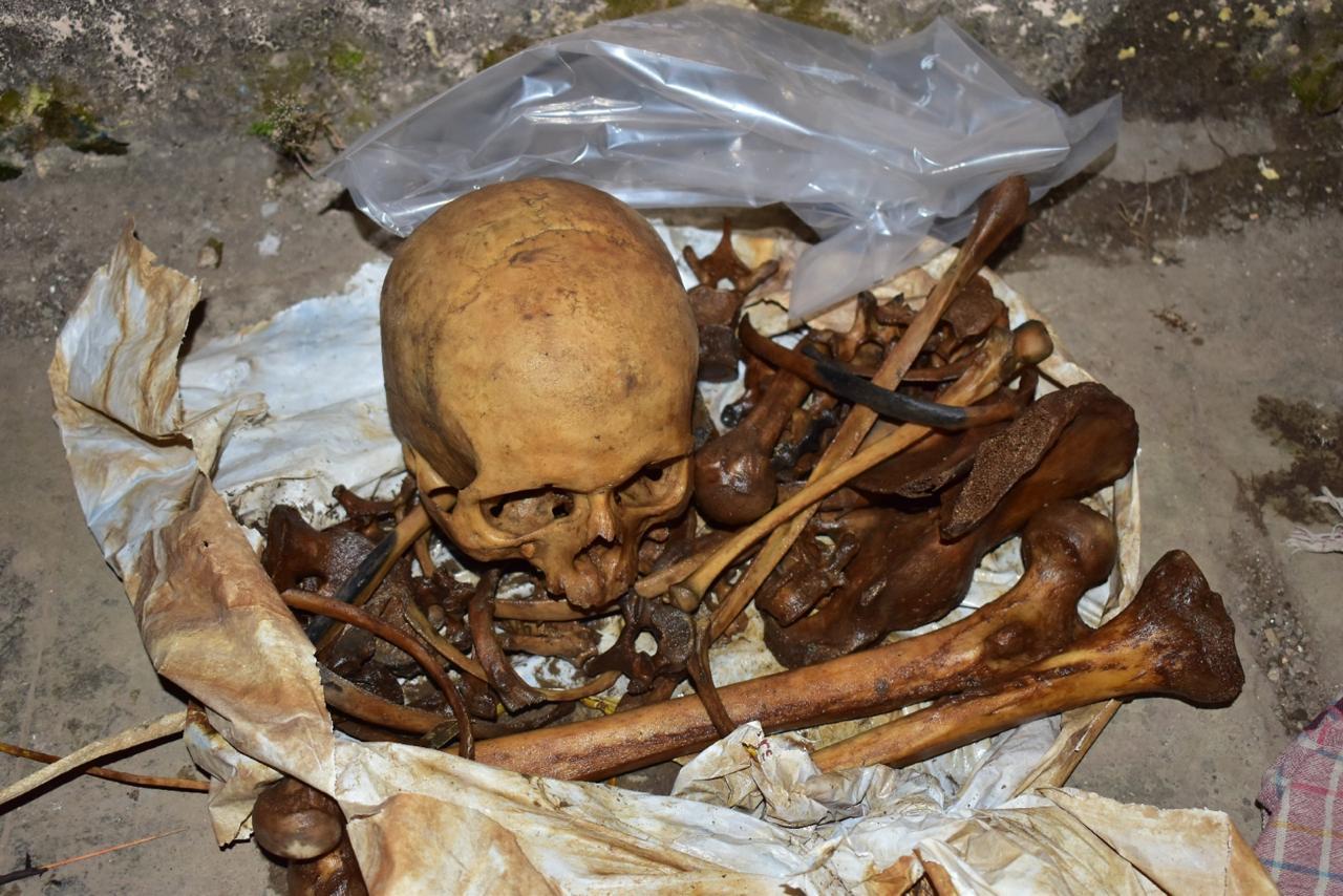 पिंपरीत सुलभ शौचालयाच्या हौदात सापडली मानवी कवटी आणि हाडं..!